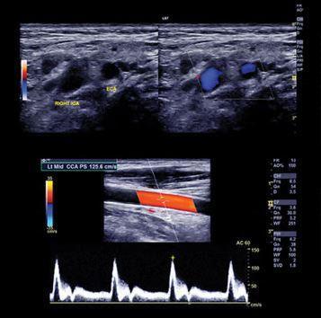 Clinical Approach to Vascular Ultrasound and RPVI Prep Course 2021 - Medical Videos | Board Review Courses