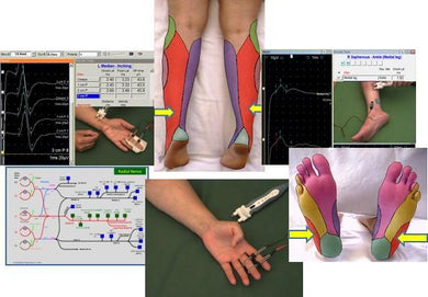 EMG/NCS Online Series: Volume III Sensory Nerve Conduction Studies (2nd Edition) (Videos) - Medical Videos | Board Review Courses
