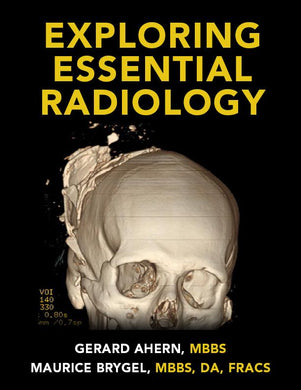 Exploring Essential Radiology (Videos) - Medical Videos | Board Review Courses