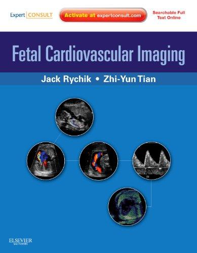 Fetal Cardiovascular Imaging: A Disease Based Approach (Videos, Organized) - Medical Videos | Board Review Courses