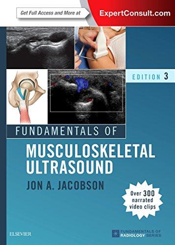 Fundamentals of Musculoskeletal Ultrasound (Fundamentals of Radiology), 3rd Edition (Videos, Organized) - Medical Videos | Board Review Courses