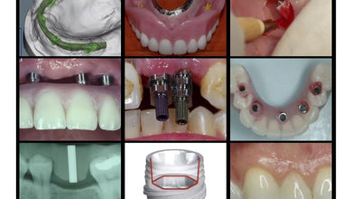 Gidedental A-Z in Restorative Implant Dentistry - Medical Videos | Board Review Courses