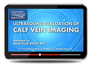 Gulfcoast Ultrasound Evaluation for Calf Vein Imaging (Videos+PDFs) - Medical Videos | Board Review Courses