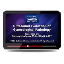 Gulfcoast Ultrasound Evaluation of Gynecological Pathology - Medical Videos | Board Review Courses