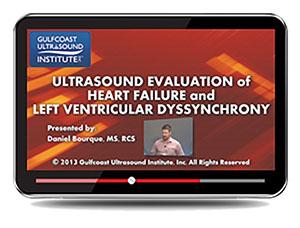 Gulfcoast Ultrasound Evaluation of Heart Failure and Left Ventricular Dyssynchrony (Videos+PDFs) - Medical Videos | Board Review Courses