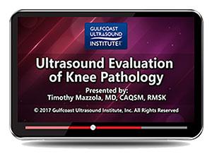 Gulfcoast Ultrasound Evaluation of Knee Pathology (Videos+PDFs) - Medical Videos | Board Review Courses