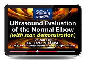 Gulfcoast Ultrasound Evaluation of the Normal Elbow (Videos+PDFs) - Medical Videos | Board Review Courses