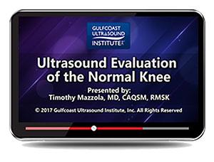 Gulfcoast Ultrasound Evaluation of the Normal Knee Training (Videos+PDFs) - Medical Videos | Board Review Courses