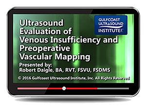 Gulfcoast Ultrasound Evaluation of Venous Insufficiency and Preoperative Vascular Mapping (Videos+PDFs) - Medical Videos | Board Review Courses