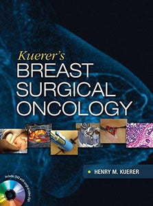 Kuerer’s Breast Surgical Oncology (Videos) - Medical Videos | Board Review Courses