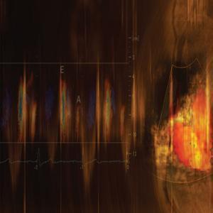 Mayo Clinic Echocardiography Board Review 2019-2020 - Medical Videos | Board Review Courses