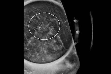 MRIOnline Imaging Mastery Series: High Risk Screening Breast MRI 2021 - Medical Videos | Board Review Courses