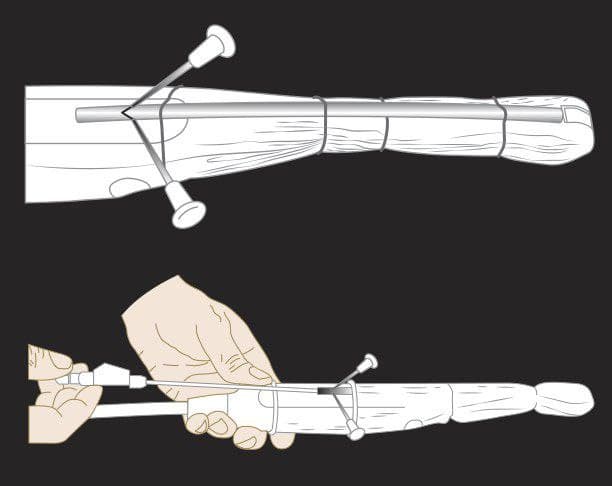 MRIOnline Imaging Mastery Series: Image-Guided Abscess Drainage in Interventional Radiology 2021 - Medical Videos | Board Review Courses