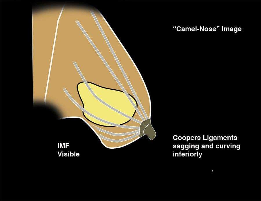 MRIOnline Imaging Mastery Series: Regulatory/Standards of Care in Breast Imaging 2021 - Medical Videos | Board Review Courses