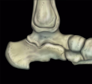MRIOnline MRI Mastery Series: Ankle 2017 - Medical Videos | Board Review Courses