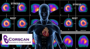 Nuclear Cardiology Board Review 2018 - Medical Videos | Board Review Courses