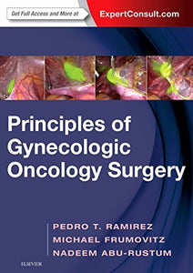 Principles of Gynecologic Oncology Surgery (Videos, Organized) - Medical Videos | Board Review Courses