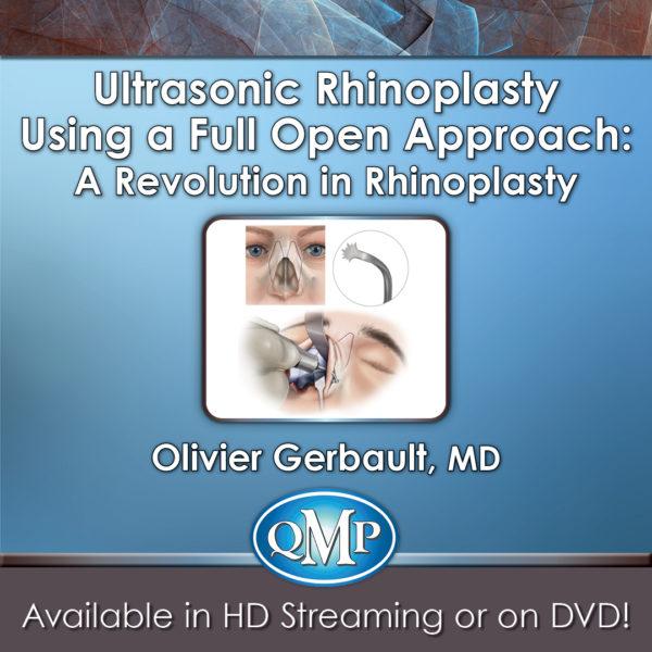 QMP Ultrasonic Rhinoplasty Using a Full Open Approach: A Revolution in Rhinoplasty 2018 - Medical Videos | Board Review Courses