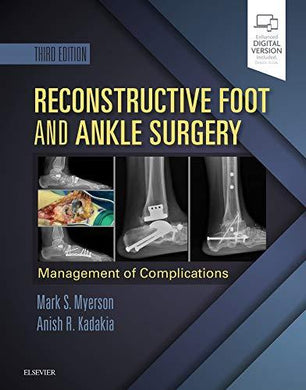 Reconstructive Foot and Ankle Surgery: Management of Complications, 3rd Edition (Videos, Organized) - Medical Videos | Board Review Courses