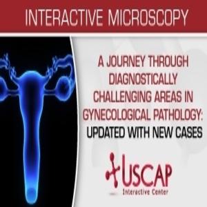 USCAP A Journey Through Diagnostically Challenging Areas in Gynecologic Pathology Updated with New Cases 2019 - Medical Videos | Board Review Courses