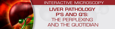 USCAP Liver Pathology P’s and Q’s: The Perplexing and the Quotidian 2022 - Medical Videos | Board Review Courses